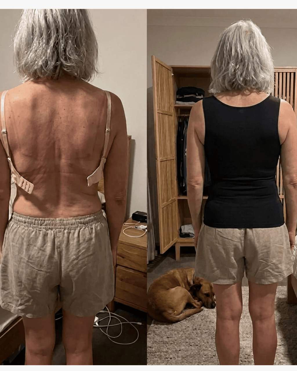 A side-by-side before and after style comparison photo showing a woman from behind in a bedroom. The left panel shows her wearing only beige shorts with a bare back and small beige straps attached; the right panel shows her wearing a black tank top and beige shorts, with a dog lying on the floor nearby.